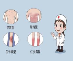 銀屑病1